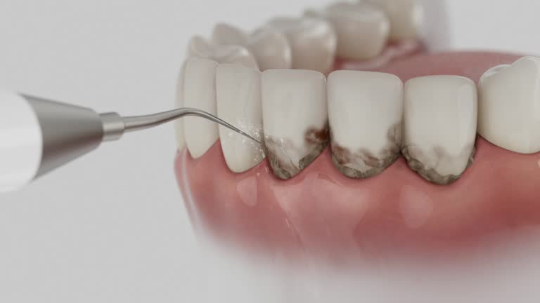 Reliable Dental Implants contractor in Colesville, MD by Smile Center Dentistry